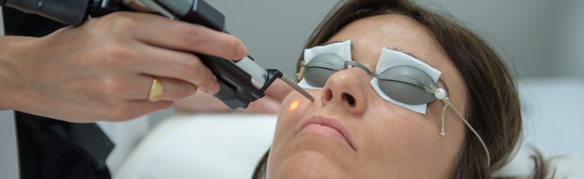 Épilation définitive au laser