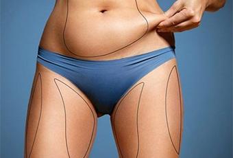 portes ouvertes coolsculpting